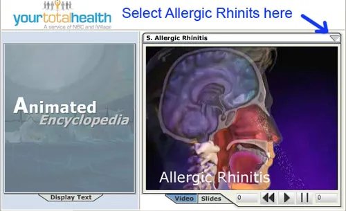The process of hay fever
